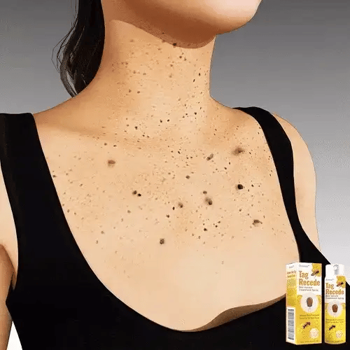 TRATAMIENTO COMPLETO: COMPRA 1 Y LLÉVATE 2 + 1 CREMA BLANQUEADORA GRATIS